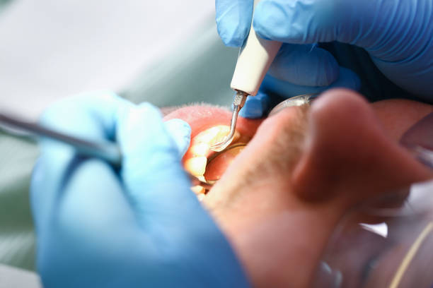 Best Urgent Tooth Repair  in Reiffton, PA